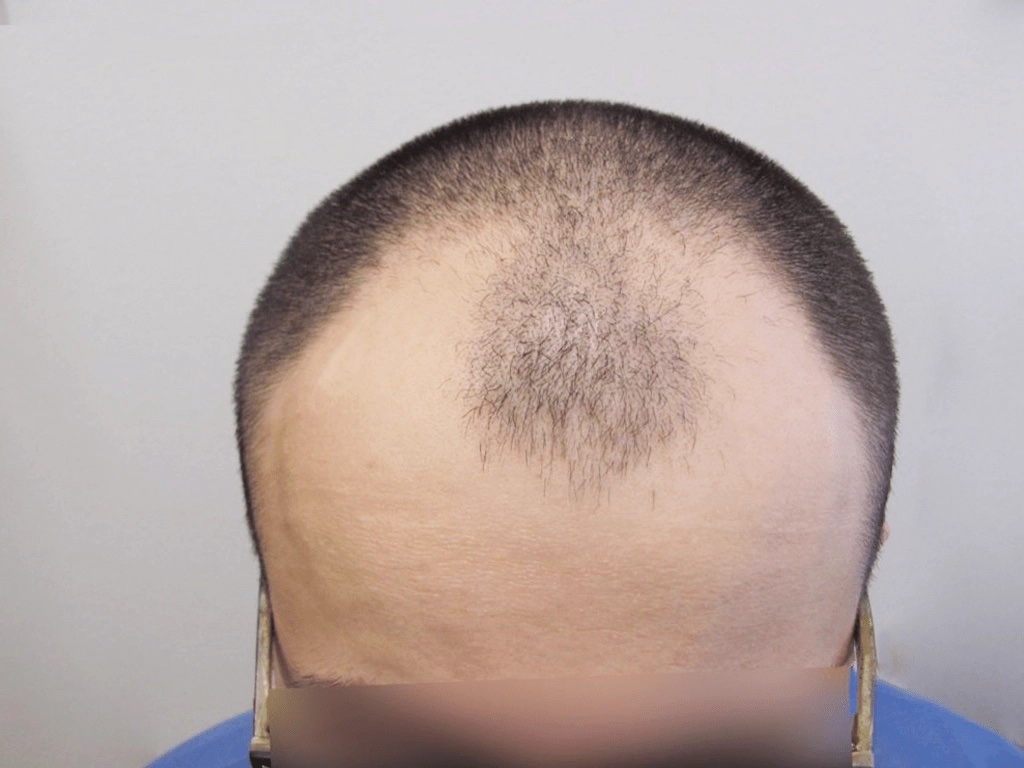 Medical Hair, Warsaw, Poland